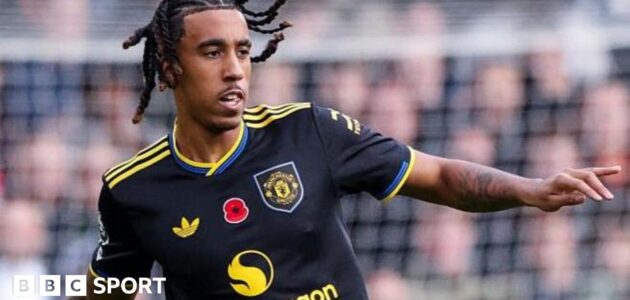 الصورة المميزة لـ: ليني يورو: لا ندم على الانتقال إلى مانشستر يونايتد رغم التحديات